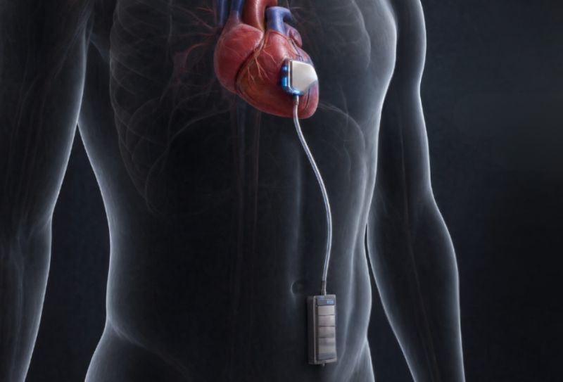 Iten adapte ses micro-batteries solides aux implants médicaux de classe III